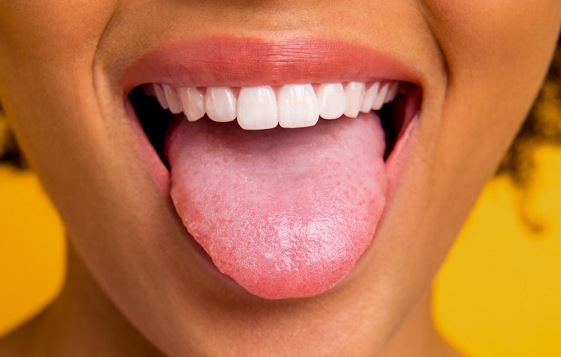 تشخیص بیماری از روی زبان