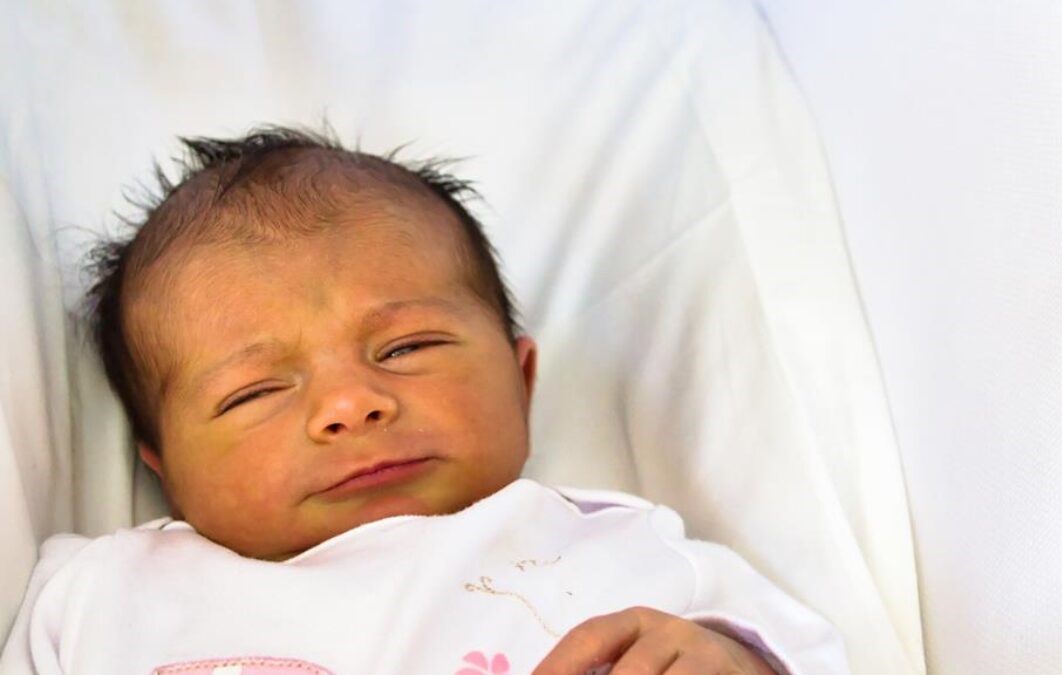 علائم زردی نوزاد - درمان زردی نوزاد در منزل